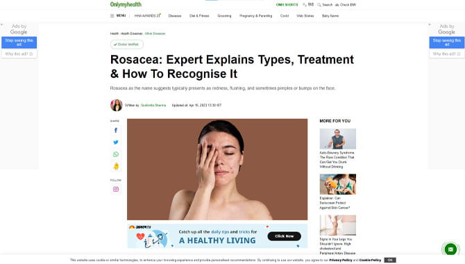Rosacea: Expert Explains Types, Treatment & How To Recognise It