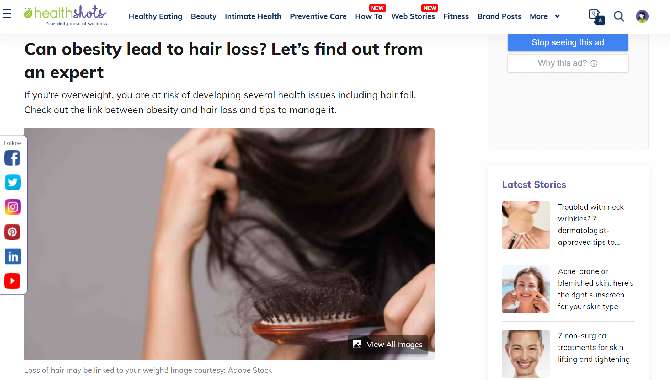 Can obesity lead to hair loss? Let’s find out from an expert