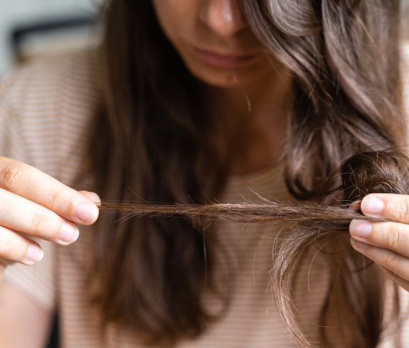 Hair Thinning Treatment in Dwarka