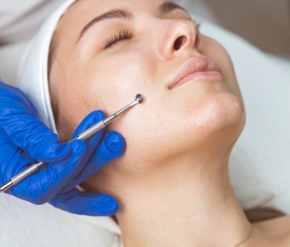 Open Pores Treatment in Dwarka